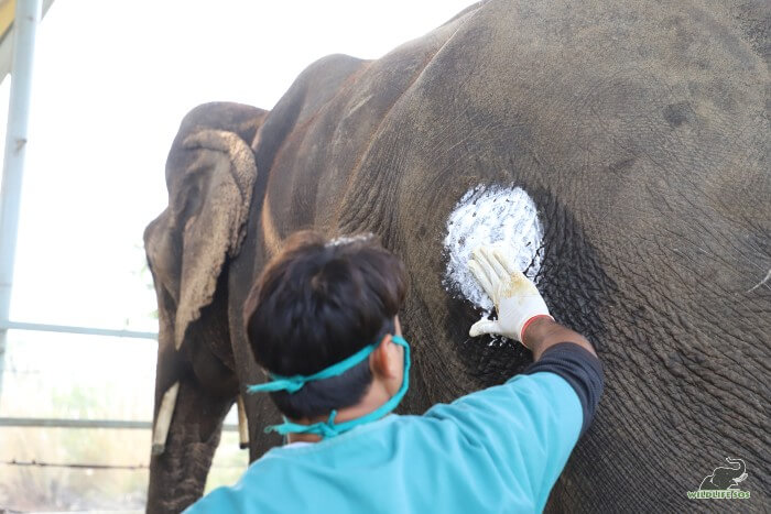 Jai's hip abscess being treated with antiseptic ointment.