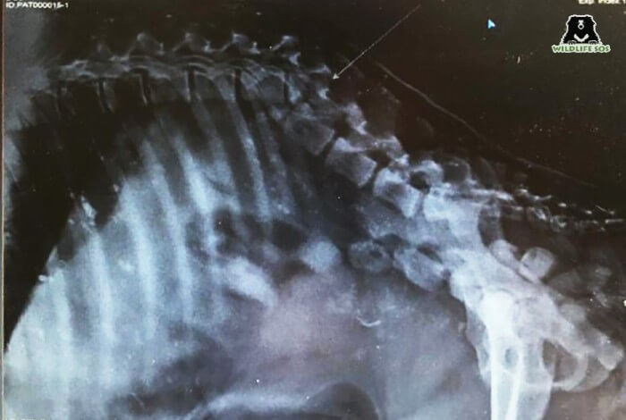 An X-Ray Examination confirms a fracture in Hyena's lower spine. 